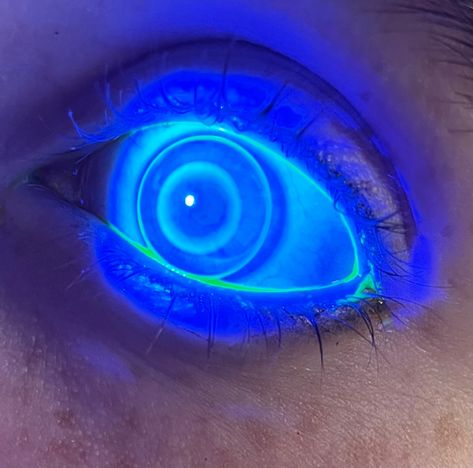 Blue Future Aesthetic, Dragon Eye Aesthetic, Glowing Blue Eyes Aesthetic, Robot Aesthetic Blue, Robot Eye Aesthetic, Blue Glowing Eyes, Electricity Aesthetic, Aliens Aesthetic, Space Eyes