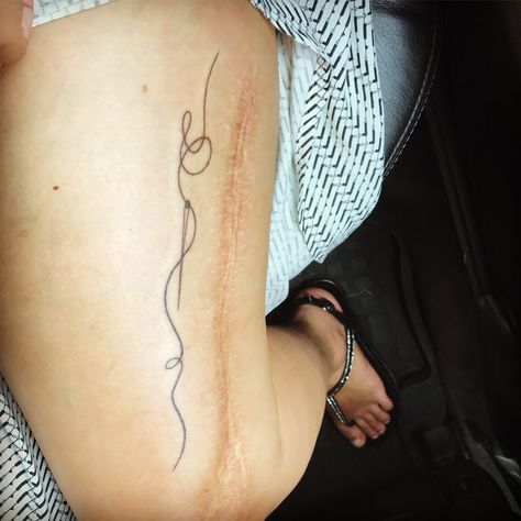 Surgical Scar Tattoo, Needle And Thread Tattoo, Thread Tattoo, James Tattoo, Tattoo Canvas, Tattoo Over Scar, Scar Tattoo, Omerta Tattoo, Skin Nails