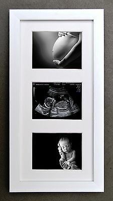 Pregnancy Scan, Vom Avea Un Copil, Perlengkapan Bayi Diy, Birth Art, Baby Picture Frames, Idee Babyshower, Baby Scan, Newborn Baby Photoshoot, Baby Room Inspiration