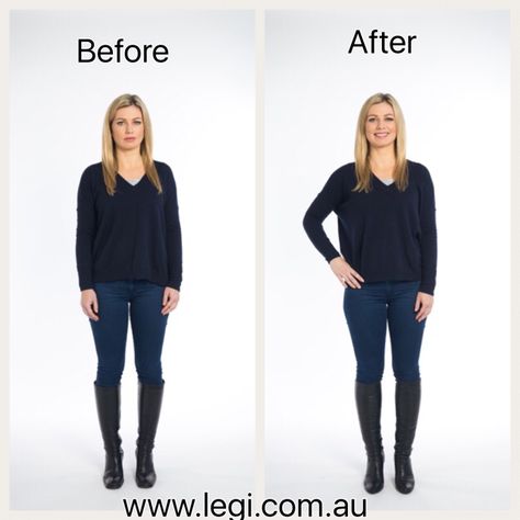 Boots anyone? ​. ​Legi. ​Bowed Legs Cosmetic Calf Support. ​Only available from www.legi.com.au or https://legi.com.au Bow Legs Outfit, Bow Legged Correction, Legs Outfit, Bow Legged, Tights Outfit, Knee High Boots, Surgery, Active Wear, Tights