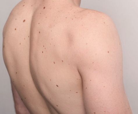 Sveinn has moles all over his body Prompto Argentum, Oh My Goddess, Dragon Age Inquisition, Stiles Stilinski, Katniss Everdeen, After Life, Obi Wan Kenobi, Obi Wan, Dragon Age