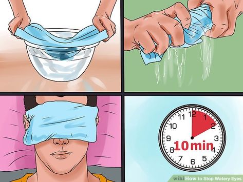 Image titled Stop Watery Eyes Step 4 Watery Eyes Remedy, Eye Function, How To Help Nausea, Eye Twitching, Eyes Watering, Irritated Eye, Allergy Remedies, Eye Infections, Watery Eyes