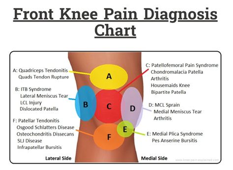 Patellar Chondromalacia, Patellofemoral Pain Syndrome Exercises, Patellofemoral Pain Syndrome, Medical Terms, Joints Pain Relief, Knee Exercises, Teaching Aids, Knee Pain, Health And Beauty Tips