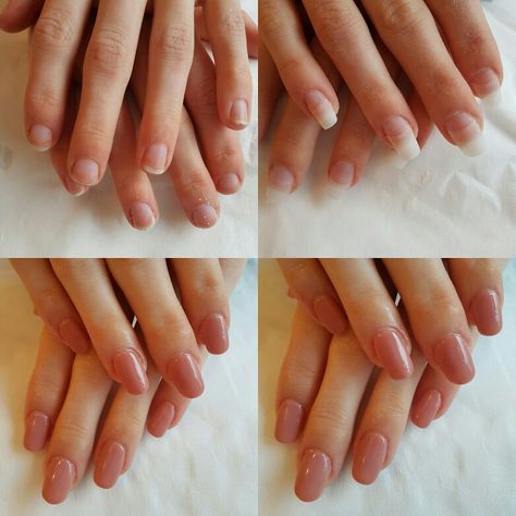 Before and after Acrylic nails with Essie Gel nude bay. Nails by Louise Essie Gel, Essie, Acrylic Nails, Nails, Beauty