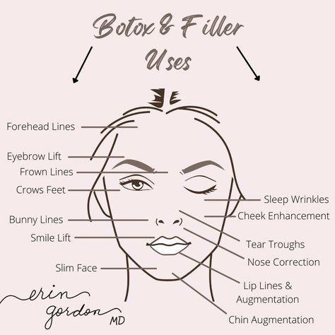 Here are the areas that people get #botox and #filler. Aesthetic Nurse Injector, Crows Feet Wrinkles, Med Spa Marketing, Chin Augmentation, Eyebrow Lift, Nurse Injector, Tear Trough, Aesthetic Nurse, Infographic Ideas