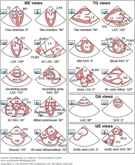 Chapter 86. Intraoperative TEE | The Anesthesia Guide | AccessAnesthesiology | McGraw-Hill Medical Cardio Sonography, Cath Lab Nursing, Ultrasound Physics, Cardiac Sonography, Medical Things, Ekg Interpretation, Sonography Student, Ultrasound Sonography, Heart Echo