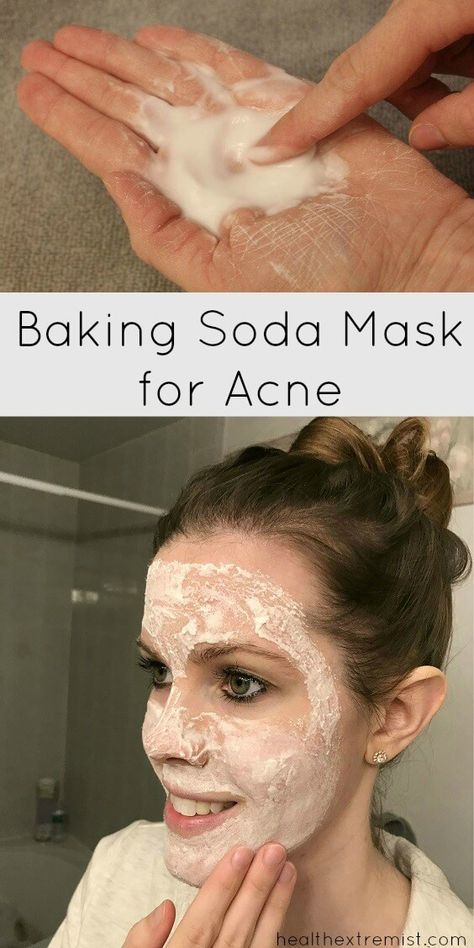 Baking Soda Mask for Acne - Prevents breakouts and fights acne Mask For Acne Prone Skin, Baking Soda Mask, Face Mask For Acne, Baking Soda Face Mask, Mask For Acne, Baking Soda Face, Tumeric Face Mask, Face Scrub Homemade, Natural Kitchen