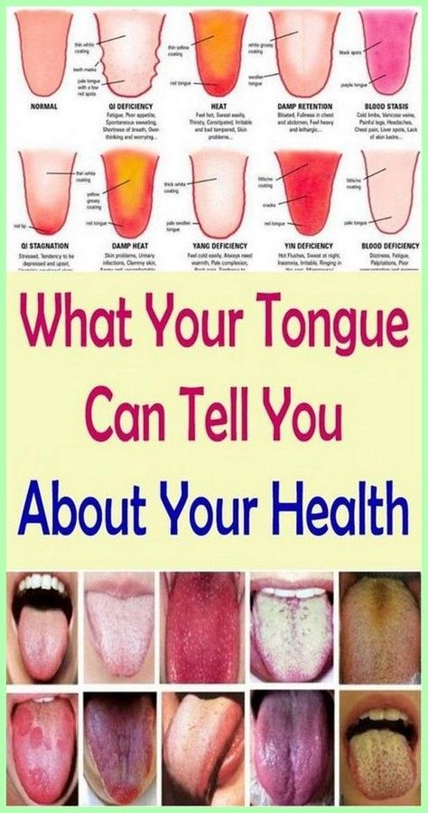 What Your Tongue Tells About Toxins In Your Body Health Signs, Tongue Health, Tongue Cleaner, Shortness Of Breath, Pose Yoga, Nail Health, Digestive System, Health Awareness, What’s Going On