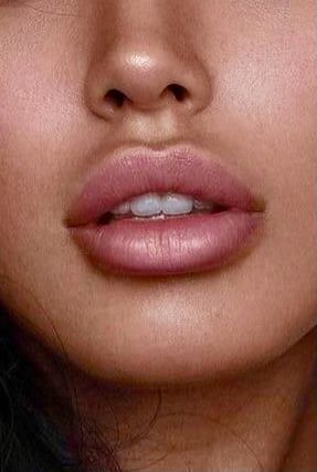 Small Plump Lips, Small Lip Filler, Lip Filler Inspiration 1ml, Lip Filler Before And After 1ml, Small Nose Big Lips, Big Lips Aesthetic, Lip Filler Shape Ideas, Desired Lips, Dream Lips