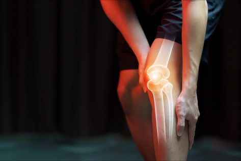 For years, osteoarthritis has caused a lot of pain in a lot of knees. The degenerative joint disease can become so debilitating that knee surgery often ends up recommended as the only solution. Schedule your patient consultation with one of our doctors at Renew Medical Centers and determine if you are a candidate. Parts Of The Knee, Increase Bone Density, Trigger Point Therapy, Knee Replacement Surgery, It Band, Knee Replacement, Healthy Joints, Bone Density, Knee Pain