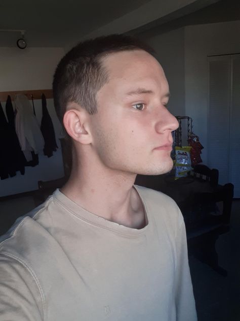 You guys think I have a good or bad hairline? And could i pull off the skin fade on the sides?- ThorGift.com - If you like it please buy some from ThorGift.com Bad Hairline, Hairstyles For Receding Hairline, Men's Hairstyle, Skin Fade, Bad Haircut, Boys Haircuts, Pull Off, The Skin, Haircuts For Men