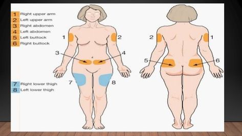 Sub Q injection site Injection Needle, Injection Sites, Subcutaneous Injection, Nurse Teaching, Lpn Schools, Nursing Board, Ms Awareness, Nursing School Survival, Nursing School Studying