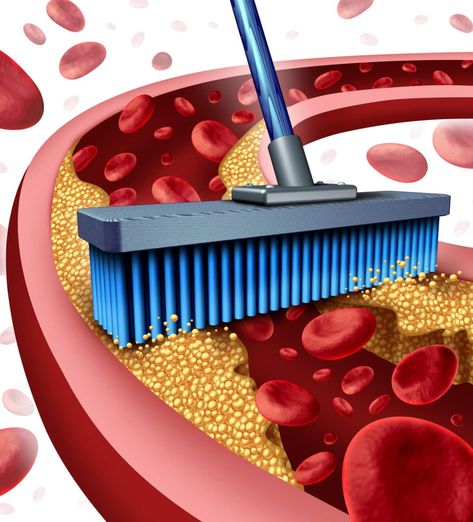 How To Unclog Arteries Naturally – 12 Proven Methods Clean Arteries, Snack Sani, High Cholesterol Levels, Carotid Artery, Clogged Arteries, Lower Your Cholesterol, Reduce Cholesterol, High Cholesterol, Natural Health Remedies