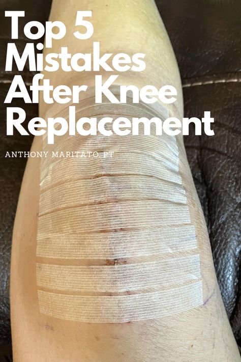 1 week post op total knee replacement Post Op Knee Replacement Exercises, Preparing For Knee Replacement Surgery, Exercise After Knee Replacement, Exercises After Knee Replacement Surgery, Knee Replacement Recovery Gifts, Knee Replacement Recovery Tips, Full Knee Replacement, Knee Replacement Pain, Hyperextended Knee