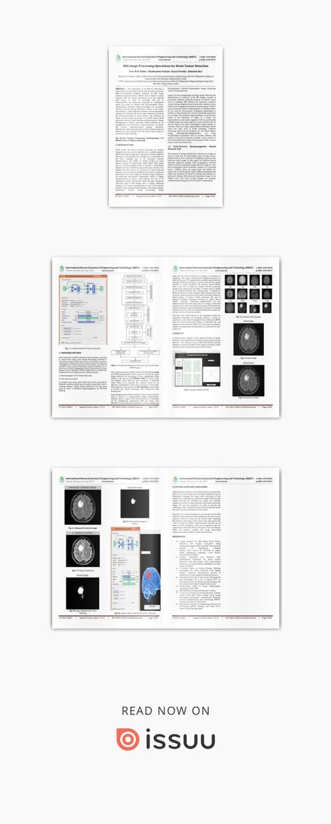 IRJET- MRI Image Processing Operations for Brain Tumor Detection  https://www.irjet.net/archives/V6/i4/IRJET-V6I4305.pdf Mri Brain, Mathematical Logic, Brain Images, Magnetic Resonance, Image Processing, Equations, Science And Nature, Journal Pages, Brain