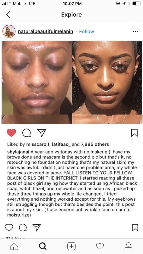 Non Toxic Skin Care, African Skin Care, Feminine Body, Body Tips, Facial Routines, Toxic Skincare, Plant Medicine, Simple Skincare Routine, African Black Soap