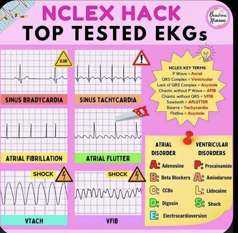 Nursing School Studying Cheat Sheets, Patient Care Technician, Nurse Notes, Nurse Teaching, Cardiac Rhythms, Nursing 101, Nursing Board, Nclex Review, Nursing School Essential