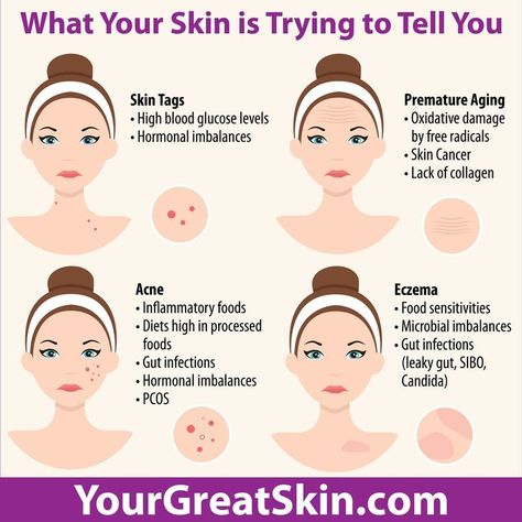 healthy skin
skin care
warning signs
health Skin Tags What Causes, Causes Of Skin Tags, Premature Aging Skin, Hormonal Imbalance, Skin Tags, Wax Strips, Hormonal Acne, Skin Diseases, Hormone Imbalance