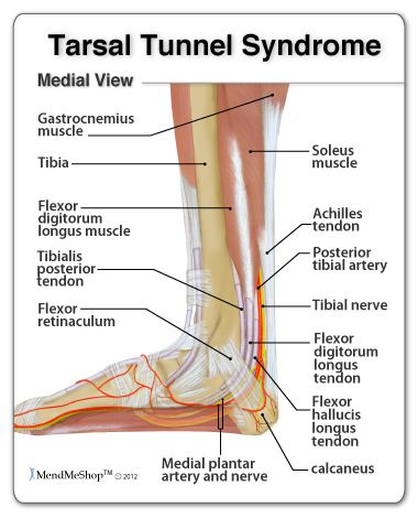 Tarsal Tunnel, Ankle Anatomy, Gastrocnemius Muscle, Calf Cramps, Ankle Pain, Pain Relief Cream, Leg Pain, Body Anatomy, Hip Pain