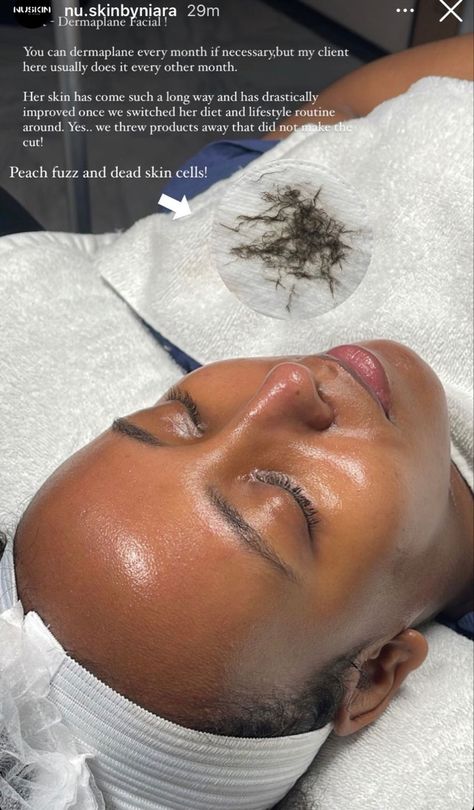 Facial Esthetics, Esthetician Inspiration, Facial Room, Medical Esthetician, Esthetician School, Esthetician Marketing, Skin Facts, Skin Care Business, Skin Aesthetics