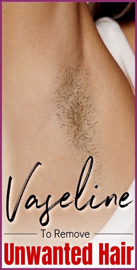 In 2 Minutes, Remove All Body Unwanted Hair Permanently At Home, With Vaseline Best Permanent Hair Removal, Chin Hair Removal, Upper Lip Hair Removal, Permanent Facial Hair Removal, Back Hair Removal, Best Facial Hair Removal, Leg Hair Removal, Electrolysis Hair Removal, Lip Hair Removal