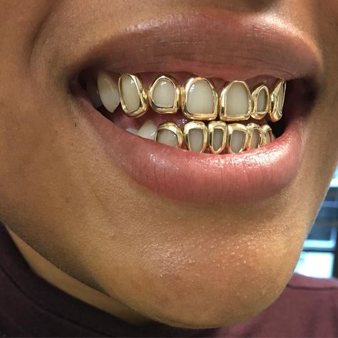 Gold Teeth Grillz, Girl Grillz, Teeth Gems, Grillz Teeth, Future Wear, Statement Piece Jewelry, Big Afro, Juniper Tree, Gold Grillz