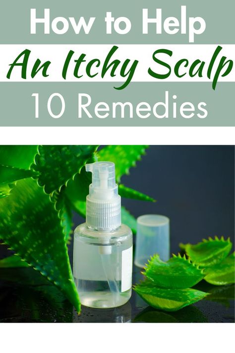 how to help itchy scalp Scalp Remedies, Itchy Scalp Remedy, Dry Scalp Remedy, Aloe Vera For Sunburn, Home Remedies For Dandruff, Home Remedies For Allergies, Scalp Itch, Warts Remedy, Dandruff Remedy