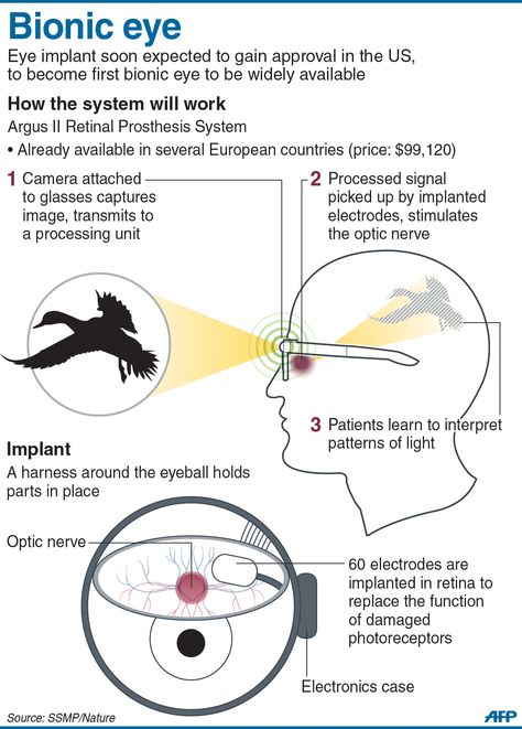 Graphic outlining how a bionic eye system works. The first retinal implant is expected to gain US approval to become the world's first widely available bionic eye. Bionic Eye Art, Optometry Notes, Information Technology Humor, Bionic Eye, Eye Structure, Future Technology Concept, Technology Humor, Basic Anatomy And Physiology, Mechanical Engineering Design