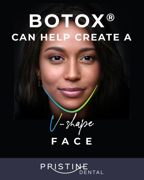 When BOTOX 💉 is injected into the jaw muscles known as masseters, it helps to create a slimmer jawline for a more 'V-shape' face. 👱‍♀️ Jaw Muscles, V Shape Face, Cosmetic Dentistry, V Shape, Muscles, To Create