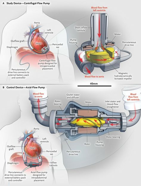 Cardiac Sonography, Cvicu Nursing, Nursing School Essential, Medical Videos, Biology Facts, Cardiac Nursing, Heart Anatomy, Critical Care Nursing, Medical School Motivation