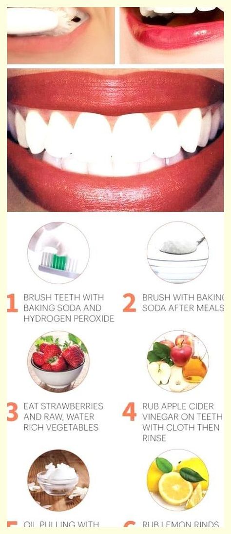 This really makes a difference. Distinctive facts! Whiten Teeth With Baking Soda, Whiten Teeth Naturally, Make Teeth Whiter, Whiten Teeth At Home, Baking Soda Teeth, Baking Soda Teeth Whitening, Best Teeth Whitening Kit, Teeth Whitening Diy, Coconut Benefits