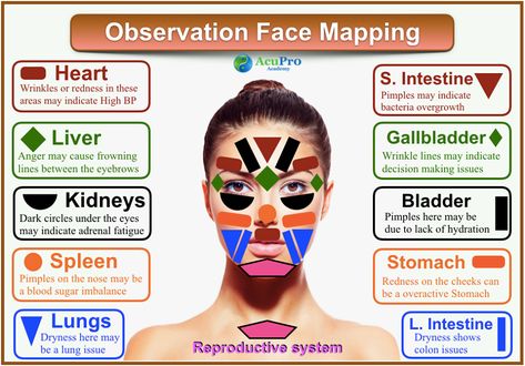 Face Mapping in Chinese Medicine | AcuPro Academy | Acupuncture Online Courses Chinese Face Map, Chinese Face Reading, Face Map, Gut Inflammation, Face Mapping, Face Reading, Natural Acne Remedies, Naturopathic Doctor, 5 Elements