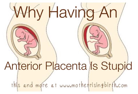 At my 20 week anatomy ultrasound appointment I asked the tech where my placenta was located.  She said I had an anterior placenta, to which I replied, "that's stupid." The ultrasound tech wondered ... Anterior Placenta, 19 Weeks Pregnant, 26 Weeks Pregnant, 20 Weeks Pregnant, Annoying Things, Ultrasound Tech, Hippie Baby, Things That Go, Birth Mother