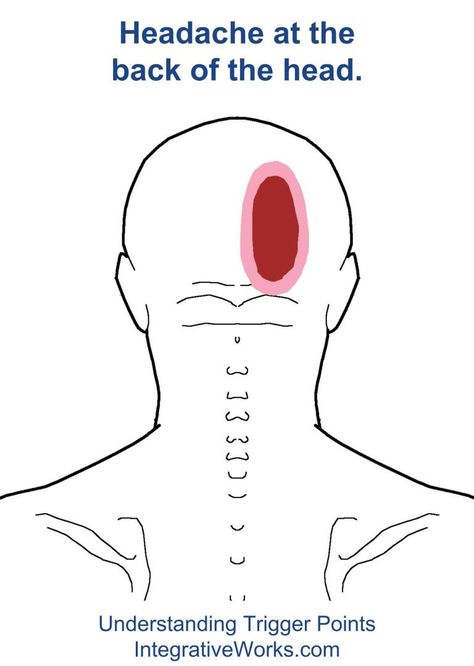 headacheIntegrative Works | Integrative Works Headache Back Of Head, Forward Head Posture Exercises, Neck And Shoulder Muscles, Forward Head Posture, Back Of Head, Head Pain, Lower Back Pain Exercises, Back Pain Remedies, Hand Massage