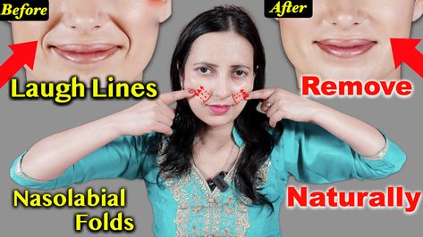 This Video How To Remove Laugh Lines | Smile Lines | Nasolabial Folds | Skin Care made for Comments received :- smile lines filler smile line exercise smile lines removal exercise Line Exercise, Laugh Lines, Smile Lines, Nasolabial Folds, Lose Belly Fat, Full Body Workout, Belly Fat, Anti Aging, Moisturizer