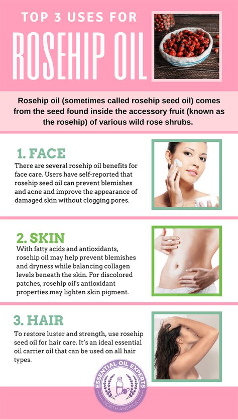 Rosehip-Oil-Uses Benefits Of Rosehip Oil, Rosehip Oil For Skin, Rosehip Oil Benefits, Oil For Skin, Blog Image, Homemade Cosmetics, Routine Tips, Rosehip Seed Oil, Natural Therapy