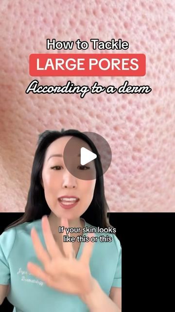 Dr. Joyce Park, Dermatologist on Instagram: "Struggling with large pores? 😩 Comment “poresize” below for a list of my favorite pore-minimizing products. Pores are totally normal, but if you want to reduce their appearance, I’ve got you covered with my top tips! From salicylic acid to sunscreen, here’s how to achieve smoother-looking skin. @cerave @cosrx @larocheposay @kiehls 🌞✨ #dermtips #teawithmd #poresize #skincaretips #largepores" Large Pores On Face Products, Pore Minimizer Serum, How To Fix Large Pores, How To Tighten Pores, How To Hide Pores With Makeup, Best Pore Filling Primer, Minimize Pores Diy, How To Make Pores Smaller On Face, Large Pores How To Get Rid Of