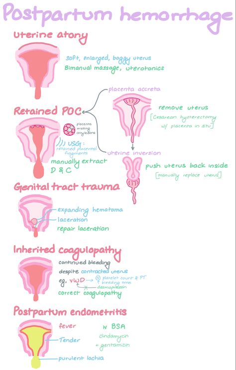 Postpartum Hemorrhage, Sonography Student, Nursing School Inspiration, Midwifery Student, Student Midwife, Nursing School Essential, Nursing School Motivation, Medical School Life, Nursing Mnemonics