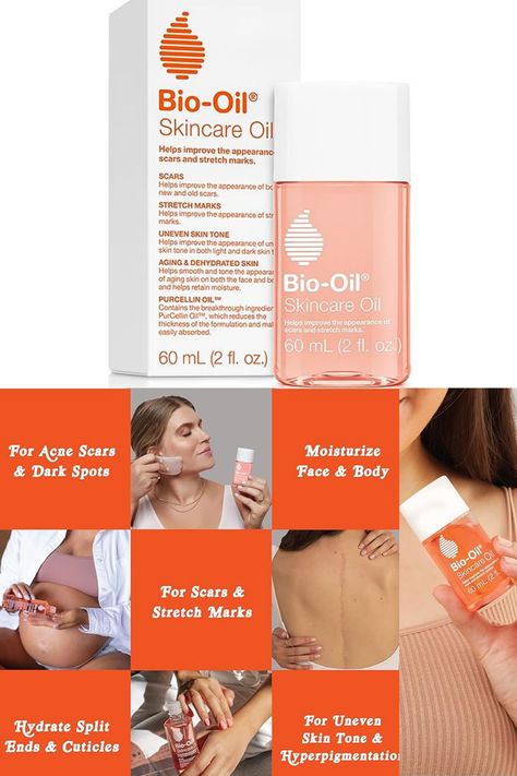 Brand	                       - Bio-Oil
Scent	                       - Calendula
Item Form	               - Oil
Active Ingredients	-vitamin_e
Unit Count	                - 2.0 Ounce

1. HELPS IMPROVES APPEARANCE OF SCARS AND STRETCH MARKS 
2. PACKED WITH Natural OILS
3. LOCKS IN ESSENTIAL HYDRATION WITHOUT CLOGGING PORES 
4. PLANET & ANIMAL FRIENDLY 
5. FORMULATED FOR ALL SKIN TYPES Bio Oil, Skin Advice, Basic Skin Care Routine, Oil Skin Care, Diy Body Care, Perfect Skin Care Routine, Dehydrated Skin, Homemade Skin Care, Body Skin Care Routine