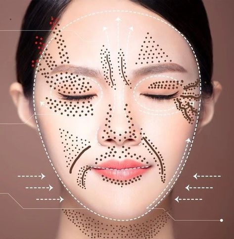 Plasma Facial, Fibroblast Plasma, Plasma Fibroblast, Skin Tightening Procedures, Remedies For Skin, For Skin Tightening, Plasma Pen, Skin Needling, Skin Tightening Treatments