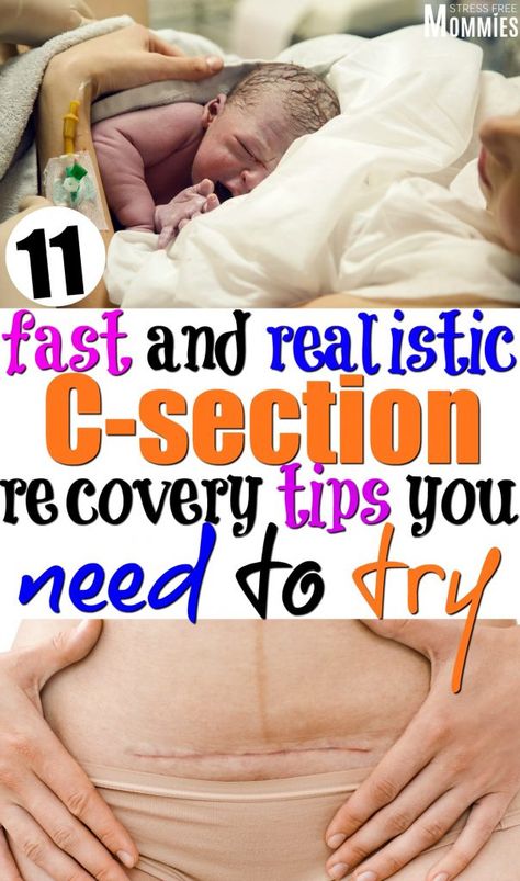 Just had a c-section? Here's a useful list of c-section recovery tips you need to try. Find out today the things that you should do after a c-section. Healing From C Section, C Section Recovery, Cesarean Section, Pumping Moms, Baby Sleep Problems, Postpartum Care, C Section, Postpartum Recovery, After Baby