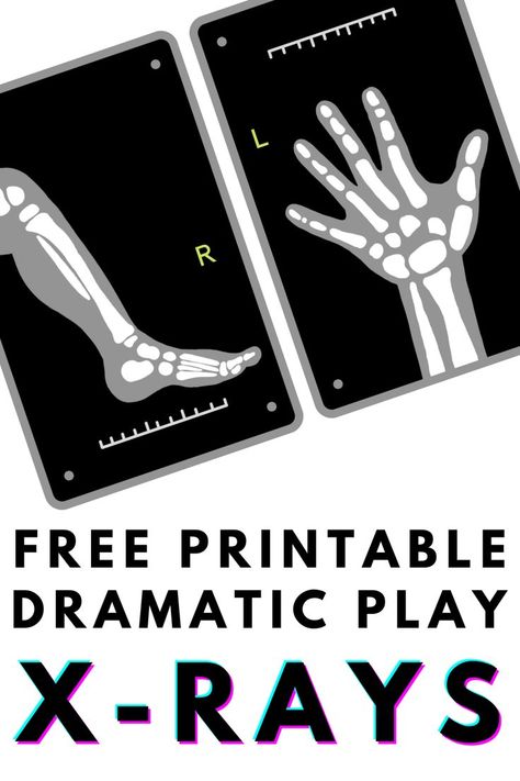 Doctor themed x-rays for dramatic play Doctor Activities For Kids, Doctor Activities, Printable Dramatic Play, Activities For Kids Preschool, Community Helpers Preschool Activities, Dramatic Play Themes, Dramatic Play Printables, Human Body Activities, Purposeful Play