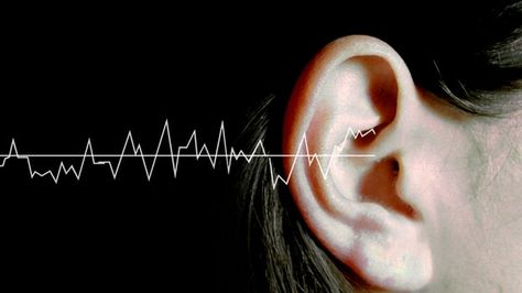 How can music make your ears bleed? Ears Bleed, Sound Technician, Music And The Brain, Hearing Problems, Science Photos, Environmental Health, Hearing Loss, Song One, Hearing Aids