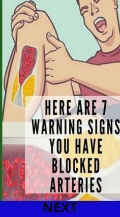 Here are 7 warning signs of clogged arteries Heart Health Awareness, Healthy Heart Tips, Healthy Living Motivation, Clogged Arteries, Health Signs, Healthy Goals, Healthy Liver, Wellness Inspiration, Healthy Mindset