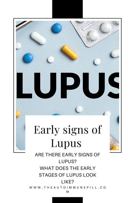 Click to check out early signs of lupus #lupus #autoimmune #autoimmunedisease #spoonie #chronicillness Autoimmune Disease Symptoms, Baby Tooth Decay, Effective Management, Thyroid Healing, Autoimmune Diet, Sjogrens Syndrome, Gum Care, Women Health, Autoimmune Disorder