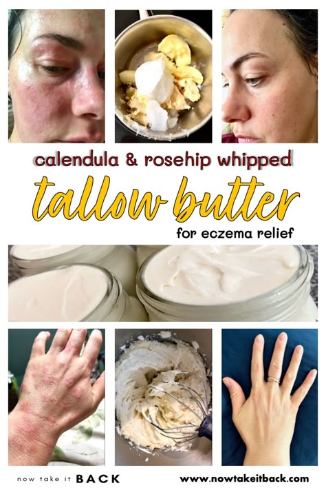 Calendula & Rosehip Whipped Tallow Butter for Eczema Relief - Now Take It Back Tallow Lotion Recipe, Tallow Lotion, Tallow Recipe, Whipped Tallow, Egg Nutrition, Tallow Balm, Salve Recipes, Lotion Recipe, Diy Kosmetik