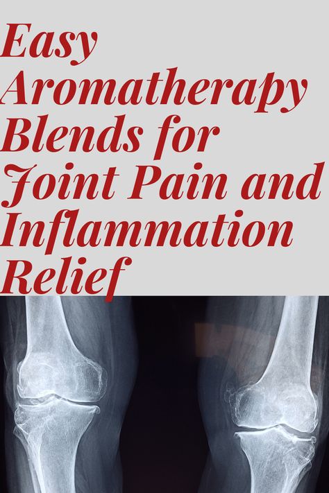 Essential Oils For Inflammation, Pain Relief Essential Oils, Arthritic Pain, Pain Relief Remedies, Essential Oils For Pain, Essential Oil Remedy, Back Pain Remedies, Essential Oils Health, Aroma Therapy