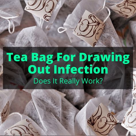 Can you really use a tea bag for drawing out infection? It is true, they do actually work for this, due to the tannins in tea. But you need to make sure you... Teabags For Eyes, Water Blister, Skin Boil, Swollen Gum, Used Tea Bags, Black Tea Bags, Green Tea Bags, Easy Drawing Steps, Eye Infections