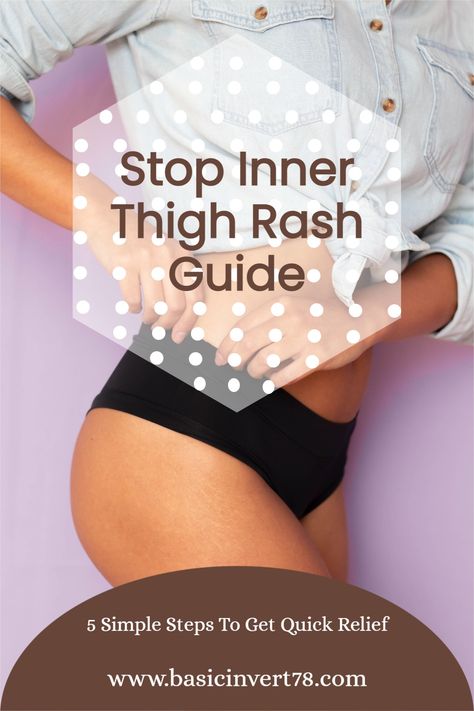 Chafing Remedies, Inner Thigh Rash, Heat Bumps, Thigh Chaffing, Leg Rash, Pole Fitness Beginner, Pole Dancing For Beginners, Rashes Remedies, Thigh Rub