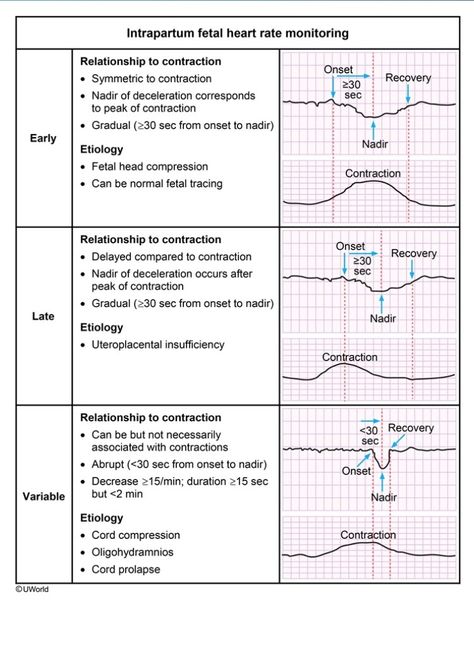 FHR Fhr Monitoring Nursing, Ob Notes Ob Nursing, Ob Medications Nursing, Labor And Delivery Medications Nursing, Fetal Heart Monitoring Nursing, Labor And Delivery Nurse Education, Intrapartum Nursing, Fetal Monitoring Nursing, Ob Nursing Student Cheat Sheets